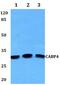 Calcium-binding protein 4 antibody, PA5-37143, Invitrogen Antibodies, Western Blot image 