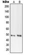 DNA Primase Subunit 1 antibody, orb214431, Biorbyt, Western Blot image 