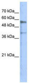 Kringle Containing Transmembrane Protein 1 antibody, TA335992, Origene, Western Blot image 