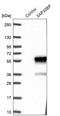 Hexon protein antibody, NBP1-83278, Novus Biologicals, Western Blot image 