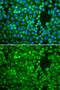 Insulin Degrading Enzyme antibody, GTX32665, GeneTex, Immunofluorescence image 