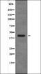 XPA, DNA Damage Recognition And Repair Factor antibody, orb336003, Biorbyt, Western Blot image 