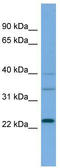 RAS Like Proto-Oncogene A antibody, TA342246, Origene, Western Blot image 