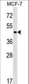 Zinc Finger And BTB Domain Containing 12 antibody, LS-C157386, Lifespan Biosciences, Western Blot image 