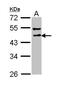 Dihydrolipoyllysine-residue succinyltransferase component of 2-oxoglutarate dehydrogenase complex, mitochondrial antibody, PA5-22239, Invitrogen Antibodies, Western Blot image 