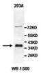 ALX Homeobox 3 antibody, orb77554, Biorbyt, Western Blot image 