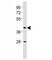 Cannabinoid Receptor 2 antibody, F53156-0.4ML, NSJ Bioreagents, Western Blot image 