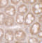 STAT3 antibody, 7197, ProSci Inc, Immunohistochemistry paraffin image 