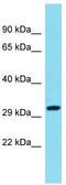 Coiled-Coil Domain Containing 82 antibody, TA330748, Origene, Western Blot image 
