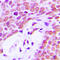 X-Ray Repair Cross Complementing 5 antibody, LS-C353017, Lifespan Biosciences, Immunohistochemistry paraffin image 