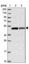 VPS37C Subunit Of ESCRT-I antibody, NBP1-83632, Novus Biologicals, Western Blot image 