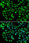 Metabotropic glutamate receptor 4 antibody, STJ29423, St John