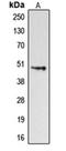 Dopamine Receptor D4 antibody, orb213858, Biorbyt, Western Blot image 