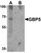 Guanylate Binding Protein 5 antibody, LS-B10102, Lifespan Biosciences, Western Blot image 