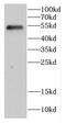 Chaperonin Containing TCP1 Subunit 2 antibody, FNab01396, FineTest, Western Blot image 