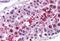 Lipase E, Hormone Sensitive Type antibody, MBS241290, MyBioSource, Immunohistochemistry frozen image 