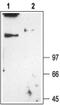 Chloride Voltage-Gated Channel 1 antibody, PA5-77371, Invitrogen Antibodies, Western Blot image 