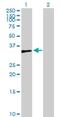 Zinc Finger Protein 75a antibody, H00007627-B01P, Novus Biologicals, Western Blot image 
