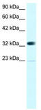 hPc2 antibody, TA329637, Origene, Western Blot image 