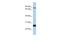 Nuclear Factor, Erythroid 2 Like 1 antibody, A06662, Boster Biological Technology, Western Blot image 