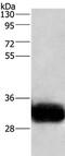 Glycoprotein M6A antibody, PA5-50350, Invitrogen Antibodies, Western Blot image 