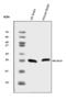 Neurocalcin Delta antibody, A09890-2, Boster Biological Technology, Western Blot image 