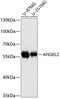Angel Homolog 2 antibody, GTX66118, GeneTex, Western Blot image 