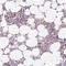 Immunoglobulin iota chain antibody, HPA055886, Atlas Antibodies, Immunohistochemistry paraffin image 