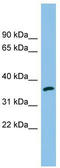 Aldo-keto reductase family 1 member C2 antibody, TA337629, Origene, Western Blot image 