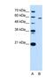 Pyruvate Kinase L/R antibody, NBP1-56319, Novus Biologicals, Western Blot image 
