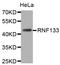 Ring Finger Protein 133 antibody, LS-C332649, Lifespan Biosciences, Western Blot image 