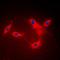 Lysophospholipase 1 antibody, orb224069, Biorbyt, Immunocytochemistry image 