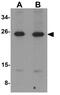 LIF Interleukin 6 Family Cytokine antibody, GTX31431, GeneTex, Western Blot image 