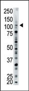 Ubiquitin carboxyl-terminal hydrolase 15 antibody, AP12031PU-N, Origene, Western Blot image 