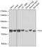 FYN Proto-Oncogene, Src Family Tyrosine Kinase antibody, 13-026, ProSci, Western Blot image 