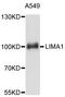LIM domain and actin-binding protein 1 antibody, abx126098, Abbexa, Western Blot image 