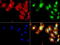 Aldehyde Dehydrogenase 1 Family Member L1 antibody, LS-C796715, Lifespan Biosciences, Immunofluorescence image 