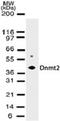 TRNA Aspartic Acid Methyltransferase 1 antibody, TA336596, Origene, Western Blot image 