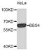 Bardet-Biedl Syndrome 4 antibody, abx125014, Abbexa, Western Blot image 