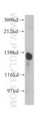 Aminopeptidase M antibody, 14553-1-AP, Proteintech Group, Western Blot image 