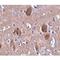 Cell Death Inducing P53 Target 1 antibody, LS-C108471, Lifespan Biosciences, Immunohistochemistry paraffin image 