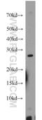 MAX Dimerization Protein 1 antibody, 17888-1-AP, Proteintech Group, Western Blot image 