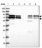 RUN And FYVE Domain Containing 1 antibody, PA5-58546, Invitrogen Antibodies, Western Blot image 