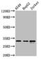RALY Heterogeneous Nuclear Ribonucleoprotein antibody, CSB-PA892332LA01HU, Cusabio, Western Blot image 