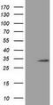 Chromosome 16 Open Reading Frame 72 antibody, GTX84758, GeneTex, Western Blot image 