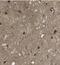 Leucine Rich Repeat Containing 3B antibody, NBP1-89579, Novus Biologicals, Immunohistochemistry paraffin image 