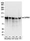 Cell Cycle Associated Protein 1 antibody, A303-881A, Bethyl Labs, Western Blot image 