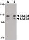 DNA-binding protein SATB1 antibody, PA5-20535, Invitrogen Antibodies, Western Blot image 