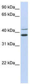 Makorin Ring Finger Protein 2 antibody, TA329835, Origene, Western Blot image 