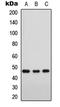 Forkhead Box D3 antibody, LS-C356037, Lifespan Biosciences, Western Blot image 